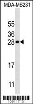 Kallikrein 7 Antibody (Center)