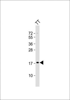 Kallikrein 7 Antibody (Center)