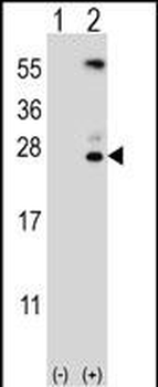 Kallikrein 6 Antibody (N-term)