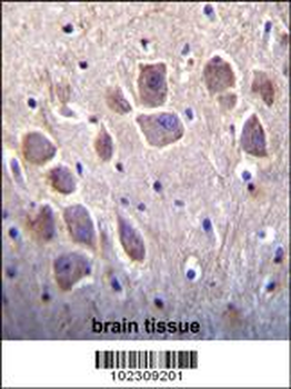 DSCR1L1 Antibody (N-term)