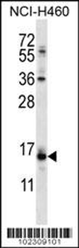 DSCR1L1 Antibody (N-term)