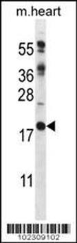DSCR1L1 Antibody (N-term)