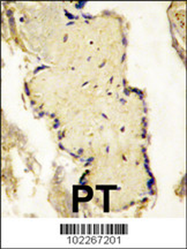 SPPL2a Antibody (N-term)