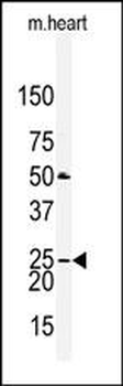 Claudin 2 (CLDN2) Antibody (N-term)