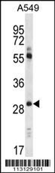 Claudin 1 (CLDN1) Antibody (Loop1)