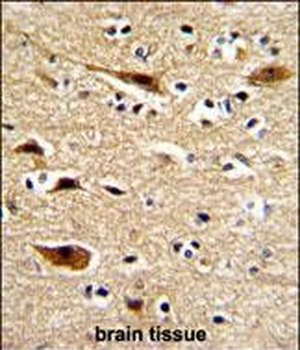 APP Antibody (N-term)