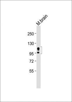 APP Antibody (N-term)