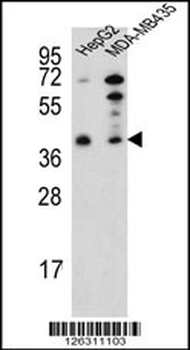PARP16 Antibody (C-term)