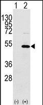 YBX1 Antibody (C-term)