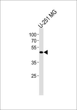 YBX1 Antibody (C-term)