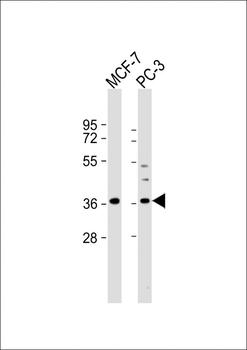 VEGF Antibody (C-term)