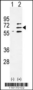 Parp6 Antibody (C-term 503)