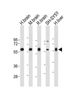 INA (alpha internexin) Antibody (Center)