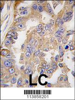AGR2 Antibody (Center)
