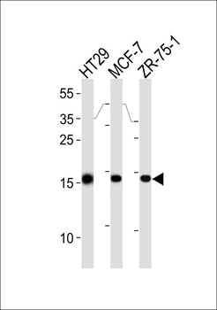 AGR2 Antibody (Center)