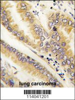 Anterior Gradient 2 (AGR2) Antibody (N-term)