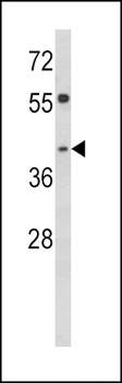 TOB2 Antibody (N-term)