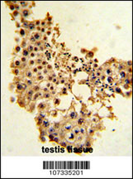 CCNE1 Antibody (C-term)