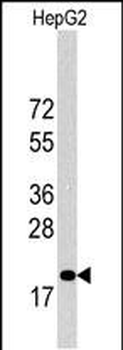 27Kip1 Antibody (C-term)