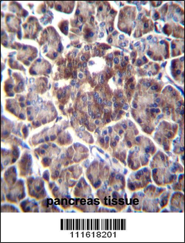 DDIT4 Antibody (C-term)