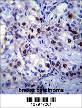 RB1 Antibody (S608)