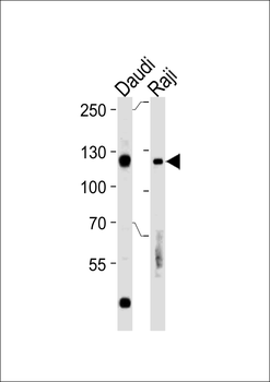 RB1 Antibody (S608)