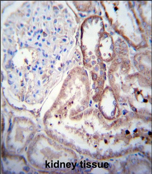 SCDGFB Antibody (Center)