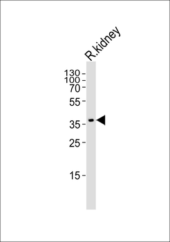 SCDGFB Antibody (Center)