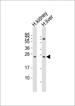 SOST Antibody (N-term)