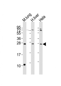 SOST Antibody (N-term)