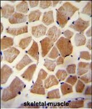 WISP2 Antibody (Center)