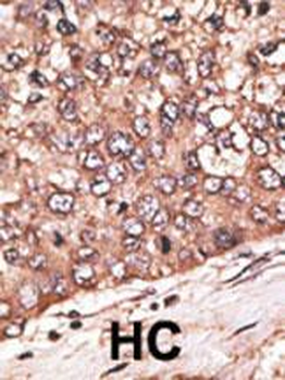 WISP1 Antibody (Center)