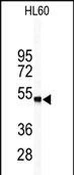 WISP1 Antibody (Center)