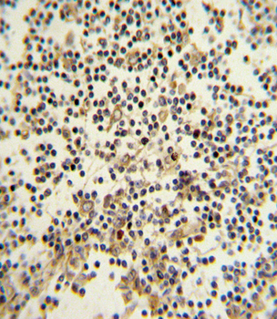 CD82 (ST6) Antibody (C-term)