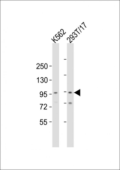 RAI17 Antibody (C-term)