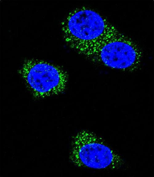 Presenilin 1 (PSEN1) Antibody (C-term)