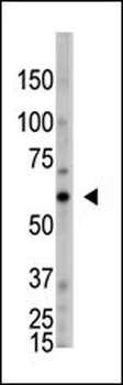 OASL Antibody (C-term)