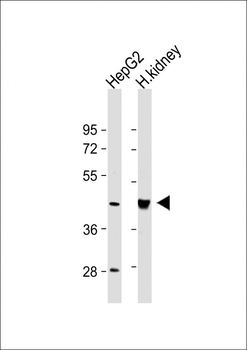 OAS1 Antibody (C-term)