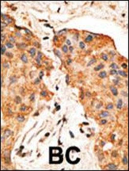 NRG1 Antibody (Center)