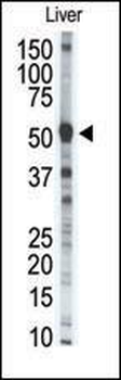 MMP8 Antibody (Center)