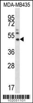 MMP16 Antibody (N-term)