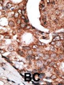 MLLT6 Antibody (C-term)