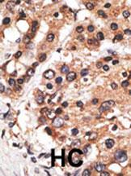 AF9 (MLLT3) Antibody (C-term K486)