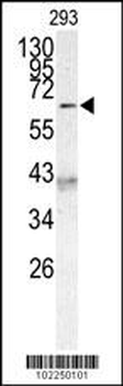 AF9 (MLLT3) Antibody (C-term K486)