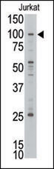 MLLT10 (AF10) Antibody (C-term)