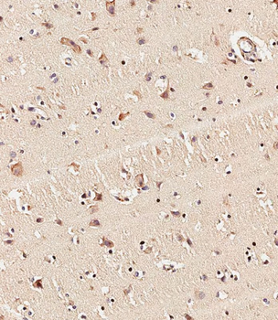 MLL2 Antibody (C-term)