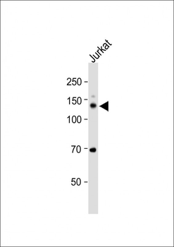 MAGEL2 Antibody (C-term)