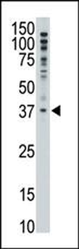 MAGEF1 Antibody (C-term)