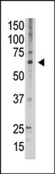 MAGED2 Antibody (C-term)