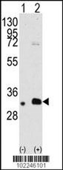 MAGEB2 Antibody (N-term)